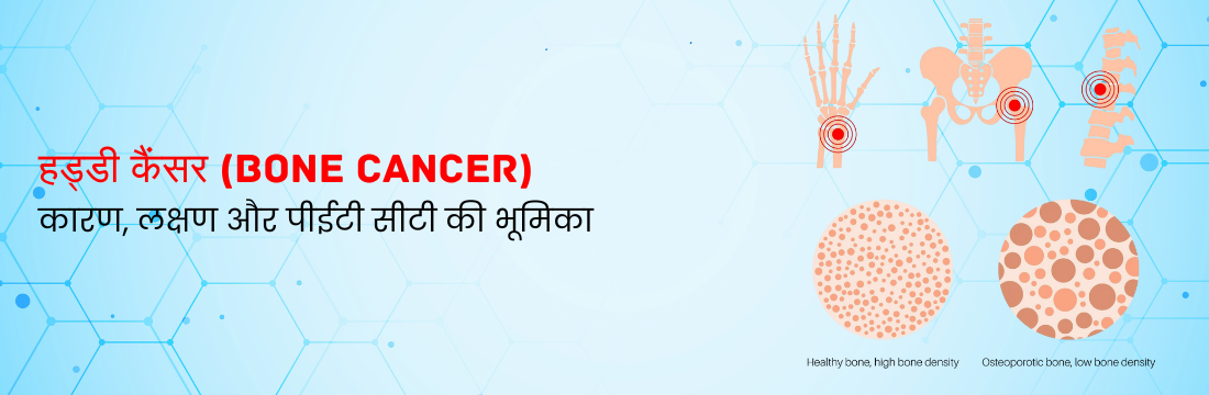 हड्डी कैंसर: कारण, लक्षण और पीईटी सीटी की भूमिका